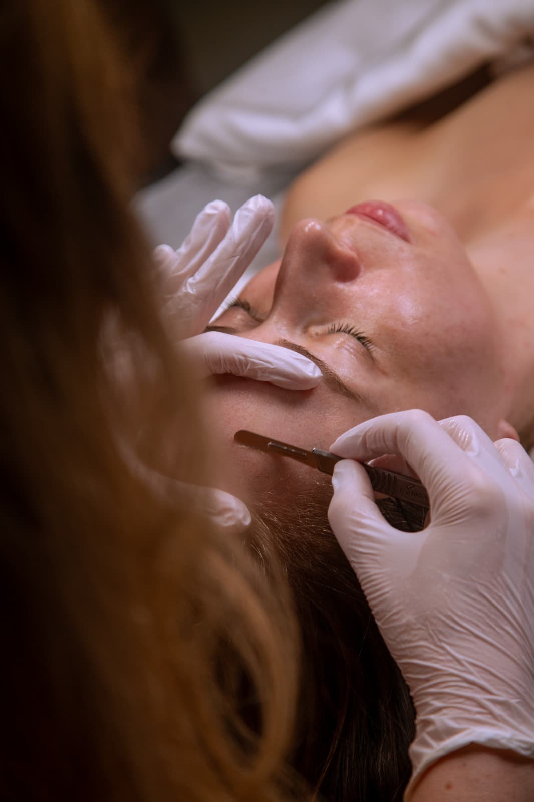 Dermaplaning