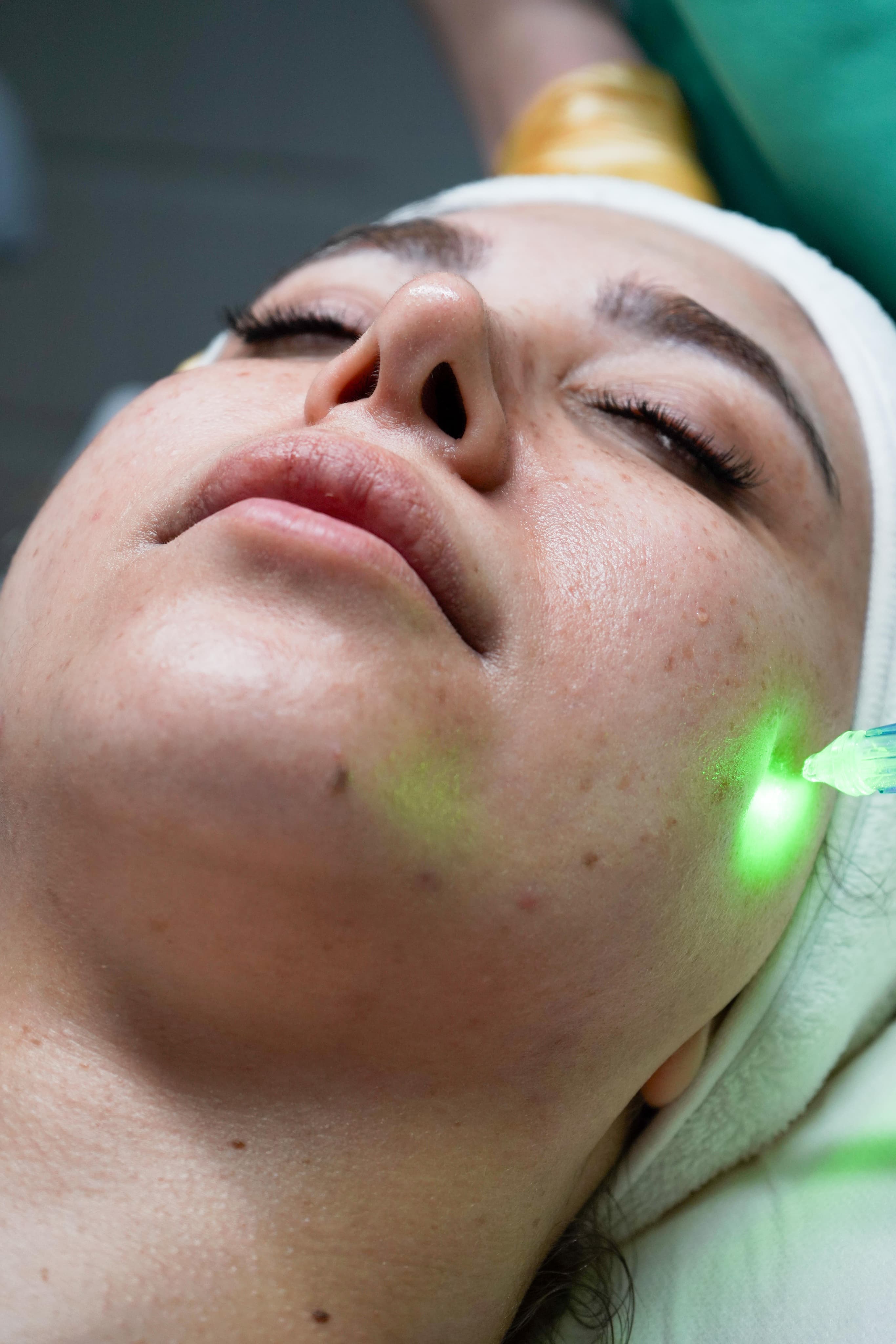 Sculpt Facial With Neurotris